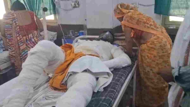 रीवा में सिलेंडर ब्लास्ट से बड़ा हादसा, मकान में लगी भीषण आग, परिवार के 4 लोग झुलसे