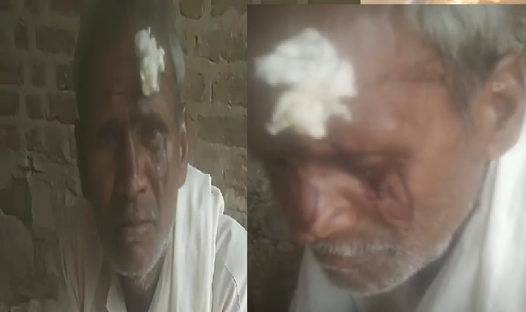 पारिवारिक विवाद बना हिंसा, बेटे ने पिता पर किया हमला और दी जान से मारने की धमकी