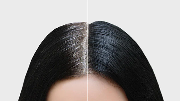 White to Black Hair Remedy: नारियल तेल से सफेद बालों की समस्या का घरेलू समाधान