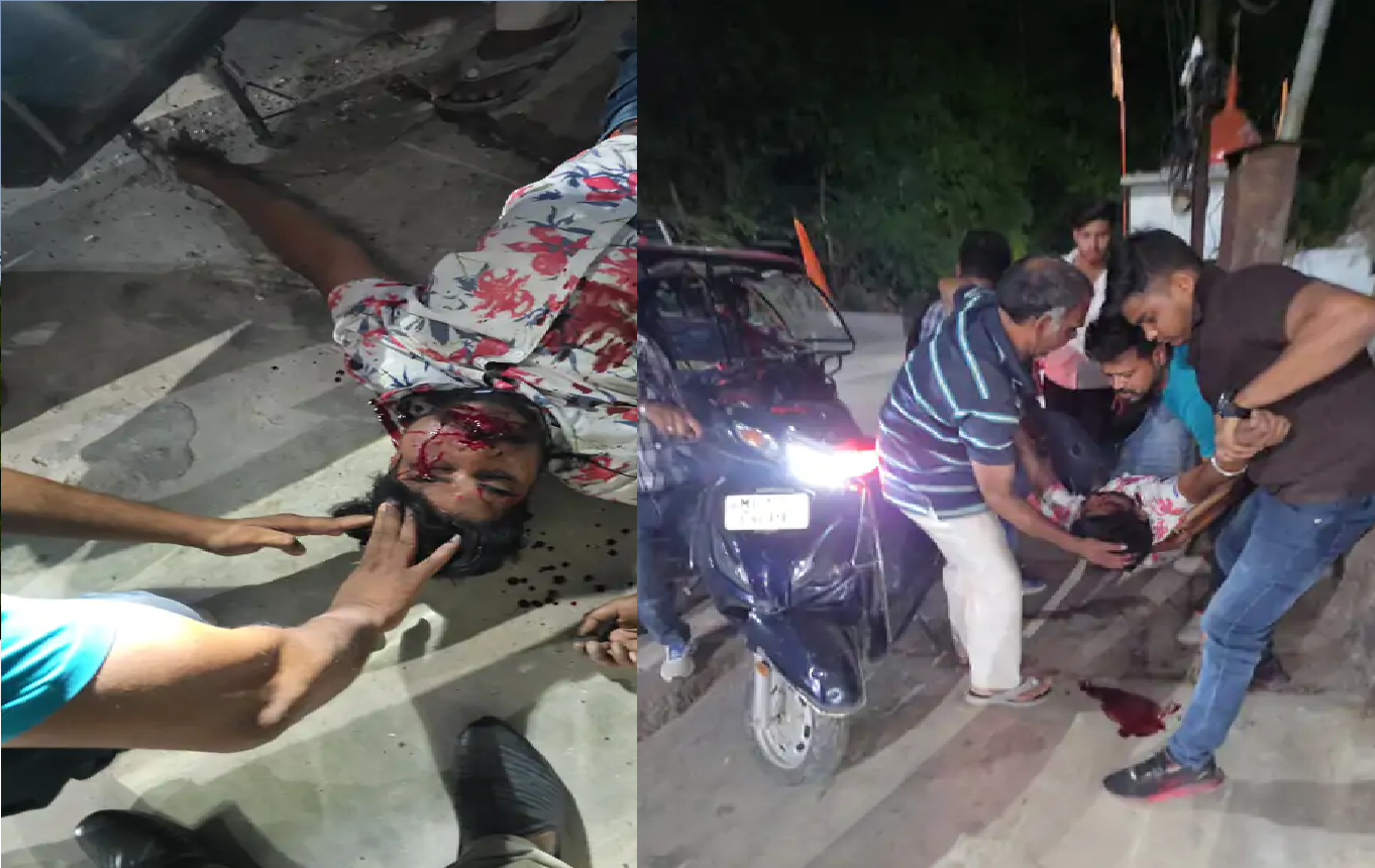स्कूटी से भागते समय दीवार से टकराया युवक, सड़क पर घंटों खून से लथपथ पड़ा रहा