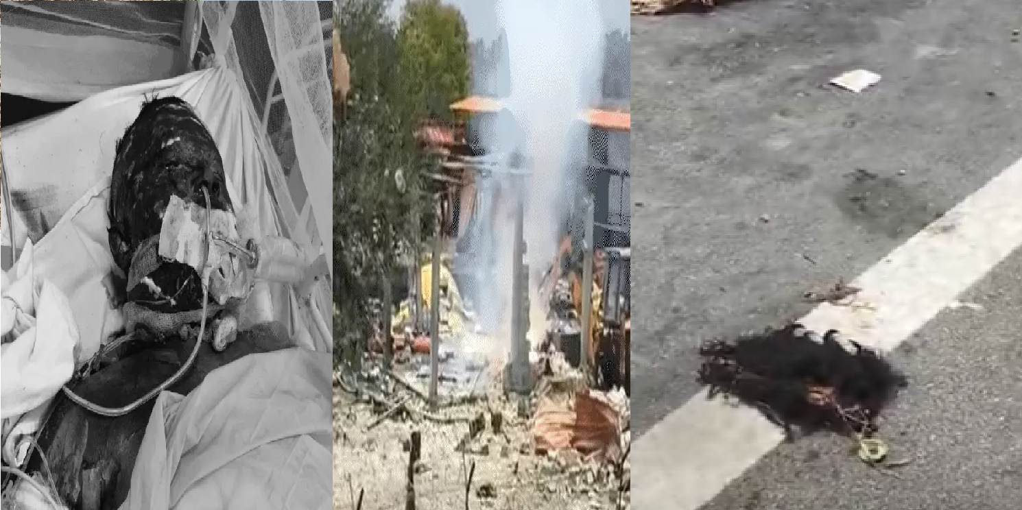 1500 किमी दूर से आए मजदूरों की हालत गंभीर, देवास हादसे में बढ़ा मौत का खतरा