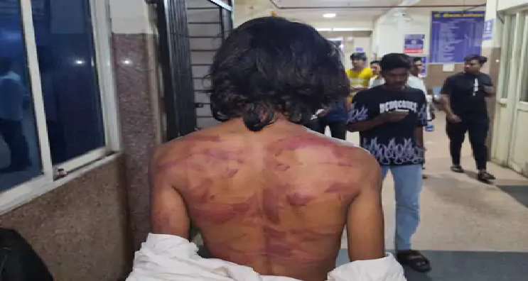 श्मशान घाट के पास हमला, युवक घायल-दो आरोपियों ने दी जान से मारने की धमकी