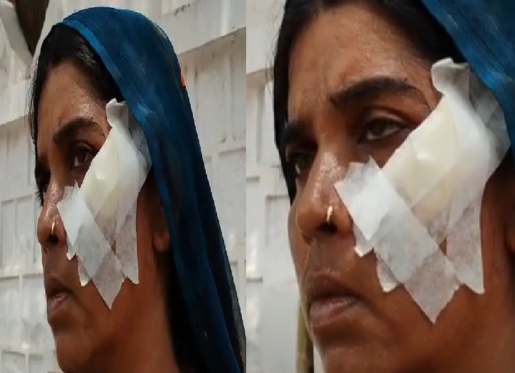 थाली में पानी गिरने से शुरू हुआ विवाद, मारपीट में महिला घायल: टांके लगे, 5 दिन बाद भी FIR दर्ज नहीं, एसपी ऑफिस के चक्कर लगा रही पीड़िता