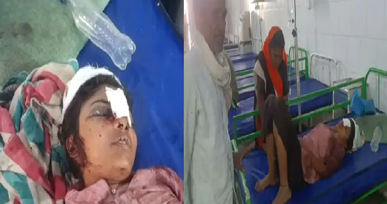 छिंदवाड़ा में युवती पर जानलेवा हमला: घर में अकेली सोते समय सिर पर वार, हालत गंभीर