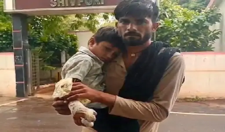 6 वर्षीय बच्चे पर कुल्हाड़ी से हमले का आरोप, कार्रवाई की मांग को लेकर एसपी कार्यालय पहुंचे परिजन