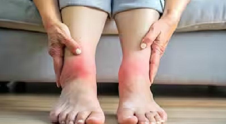 Health Alert: अगर बार बार सूज रहे हैं पैर तो हो जाएं सतर्क शरीर दे रहा है गंभीर बीमारी का संकेत