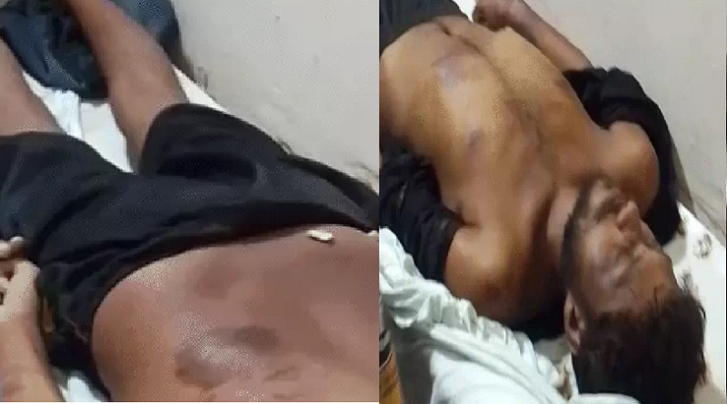 जेल पहुंचने के 48 घंटे बाद बंदी ने तोड़ा दम, शरीर पर मिले चोट के निशान; पुलिस पर गंभीर आरोप
