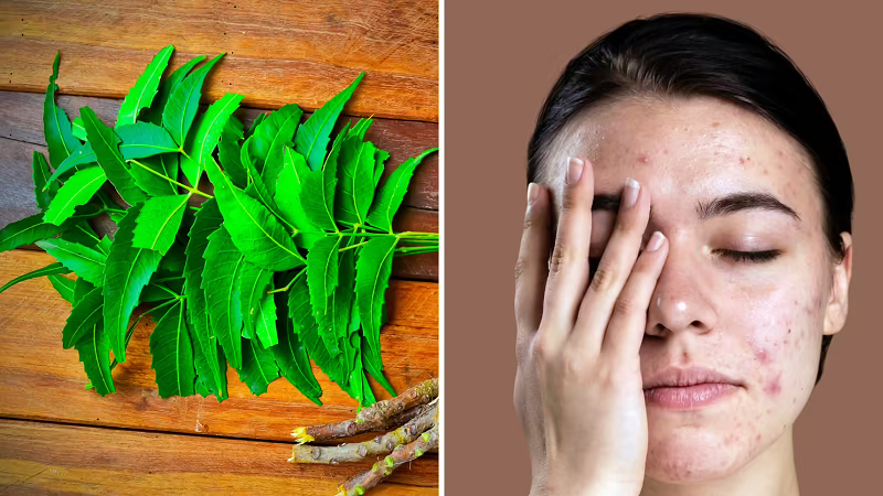 चेहरे की खूबसूरती के लिए नीम का ऐसे करें इस्तेमाल: दाग-धब्बे और पिंपल्स से राहत पाने में मिल सकती है मदद