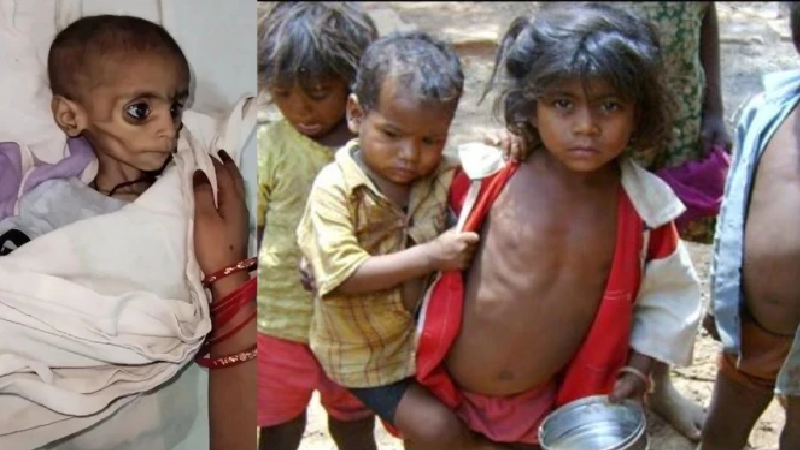बच्चों के पोषण पर संकट गहराया! प्रदेश के सभी 7 पोषण आहार प्लांट बंद, तय लक्ष्य से 130 दिन कम मिला आहार